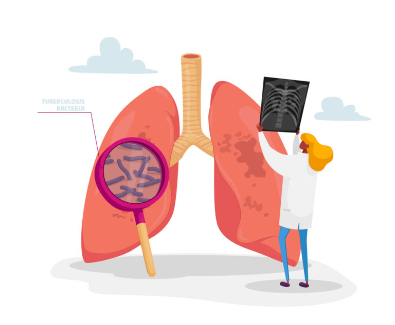 tuberculosis exam